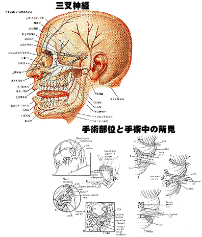 顔の痛みの分類とそれぞれの特徴 脳外科医と考える頭痛ａｔｏｚ 頭痛外来 北見クリニック
